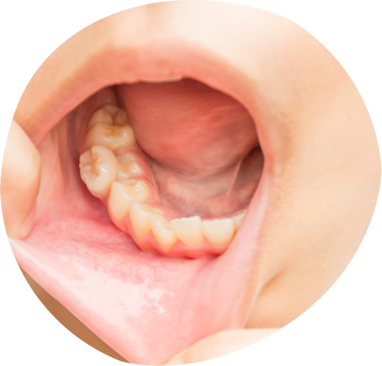 young kids teeth