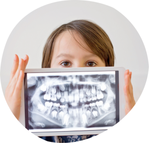 Child holding dental X-ray image, illustrating the importance of monitoring baby teeth for proper alignment and health in pediatric dentistry.