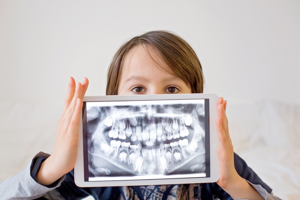 boy holding dental x-ray in front of face